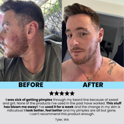Charcoal Mud Scrub